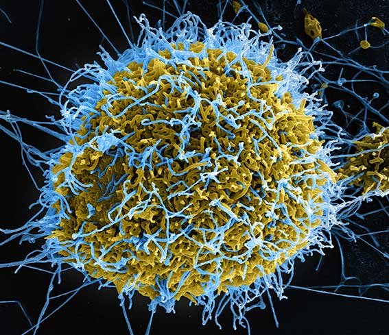 filamentous-virus-particles-scanning-electron-micrograph-cell.jpg.7e517be2ed3da46fcb090bd73a380f9a.jpg